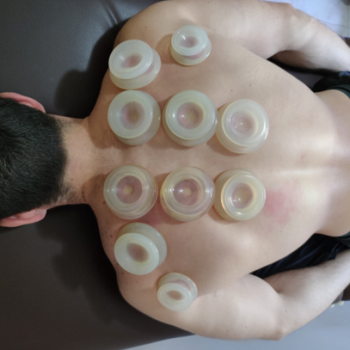 כוסות רוח לכאבים בגב עליון